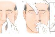 جراحی بینی استخوانی و نحوه عمل