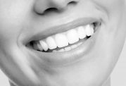 دکتر بهروزی: بررسی صفر تا صد کاشت و ایمپلنت دندان (بخش اول)