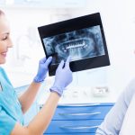 دکتر نوروززاده: عصب کشی دندان عقل