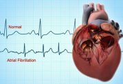 اطلاعاتی در مورد بیماری قلبی فیبریلاسیون دهلیزی