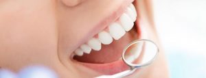 دندانپزشکی هیراد: در مورد ایمپلنت دندان چه می دانید؟