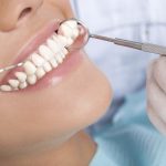 دکتر آزادمنش: چه افرادی کاندید لمینیت دندانی هستند؟