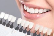 کامپوزیت دندان دندانپزشکی نارمک