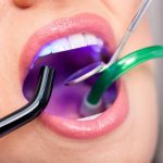 دکتر ژاله کارامد: کامپوزیت دندانی و اصلاح طرح لبخند