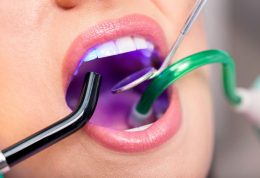 دکتر ژاله کارامد: کامپوزیت دندانی و اصلاح طرح لبخند