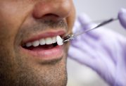 دکتر منیره تهرانی: لامینت، روشی برای زیباسازی دندان ها
