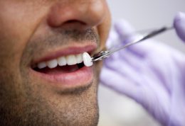 دکتر منیره تهرانی: لامینت، روشی برای زیباسازی دندان ها