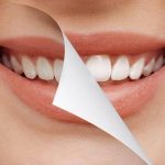 دکتر نوروززاده: هرآنچه که باید در مورد عمل افزایش طول تاج دندان بدانید