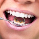 دکتر شاهین شادالوئی: ارتودنسی از پشت دندان چیست؟