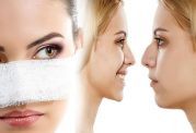 طراح طب: بررسی صورت برای جراحی بینی در شش مرحله