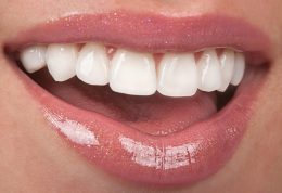دندانپزشکی نارمک: کامپوزیت چیست؟