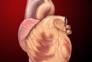عمل جراحی قلب باز چیست و چگونه انجام می شود؟