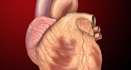 عمل جراحی قلب باز چیست و چگونه انجام می شود؟