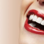 آشنایی با کامپوزیت دندان دکتر نظری