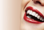 آشنایی با کامپوزیت دندان دکتر نظری