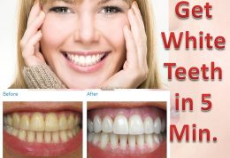روش های طبیعی برای سفید شدن دندان