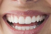 دکتر آقابیگی: آیا جرمگیری برای دندان ضرر دارد؟