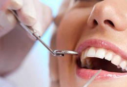 کلینیک آلما: نکاتی که باید بعد از لمینت دندان باید به آن توجه نمود