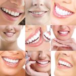 کلینیک آلما: کلیاتی در مورد درمان های زیبایی دندان پزشکی