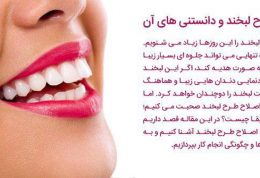 اصلاح طرح لبخند چیست؟کلینیک تخصصی دندانپزشکی دکتر فلاح