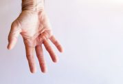 بیماری کف دست یا دوپویترن چیست؟+ 4 درمان خانگی