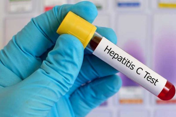 هپاتیت چیست