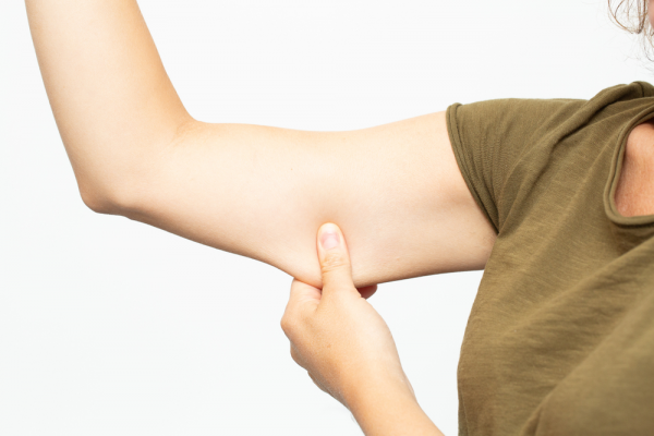 لیفت بازو یا براکیوپلاستی چیست؟