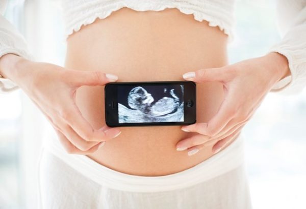 سونوگرافی چهار بعدی جنین
