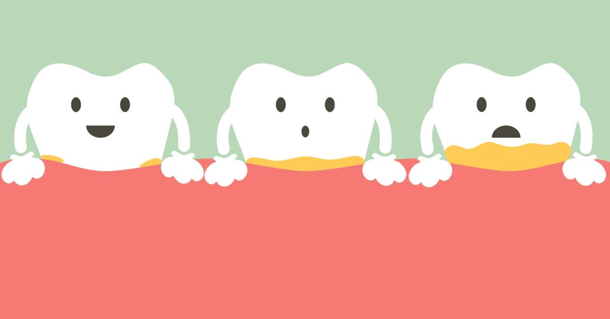راههای درمان زردی دندان را بشناسید