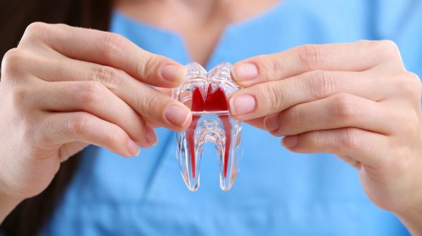 درمان کانال ریشه دندان + راهنمایی کامل
