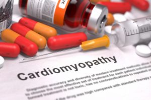 کاردیومیوپاتی یا بیماری ماهیچه قلب