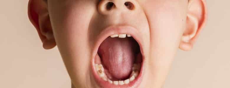 علل انواع دردهای دهان و دندان چیست؟