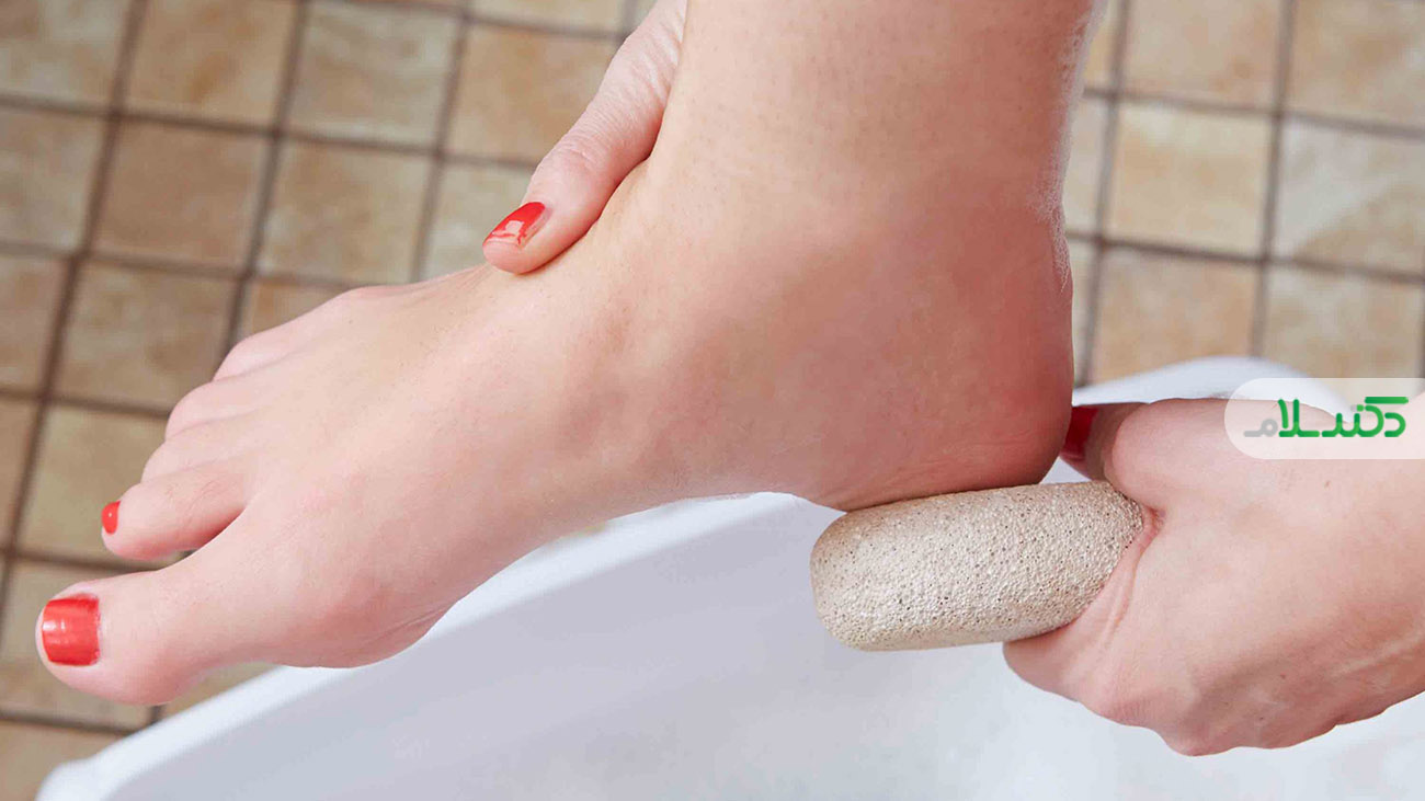 آیا استفاده از سنگ پا برای پا مضر هستند؟