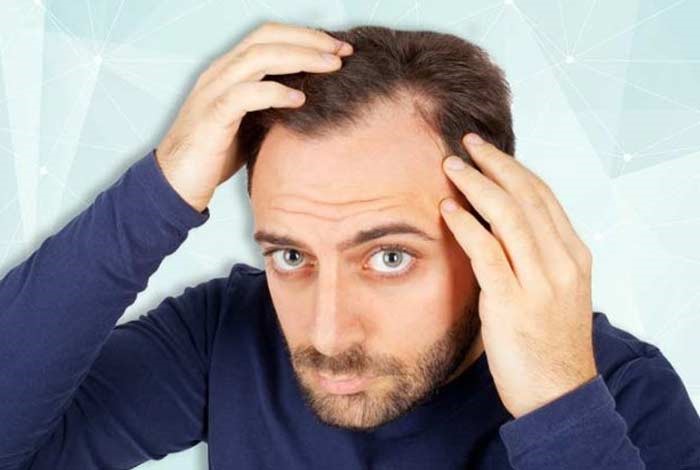 راه‌های درمان ریزش مو بعد از کرونا