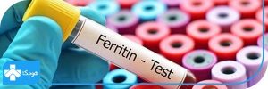 : ferritin در آزمایش خون