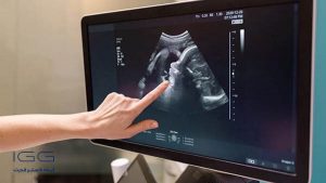 دقت سونوگرافی در تخمین وزن جنین چقدر است؟
