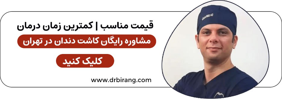دکتر احسان بیرنگ، متخصص ایمپلنت تهران