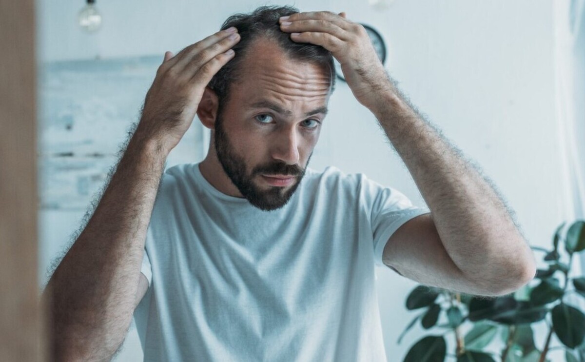 آقایان مراقب ریزش موهای خود باشند+ راههای پیشگیری